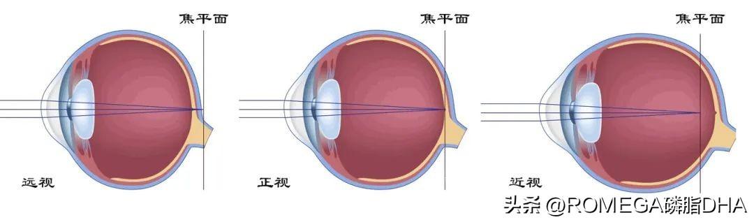 远视表下载，视力健康的关键一环